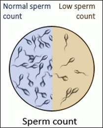 Low Sperm Count Treatment in Indore